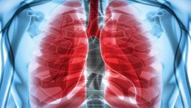 Trepulmix(曲前列素钠)注意事项