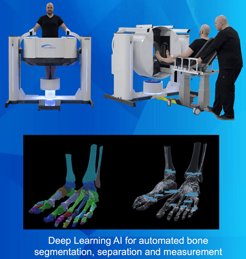 【异动股】医学成像智能扫描公司Curvebeam AI(ASX:CVB)销售势头强劲 美国订单增长迅猛飙升